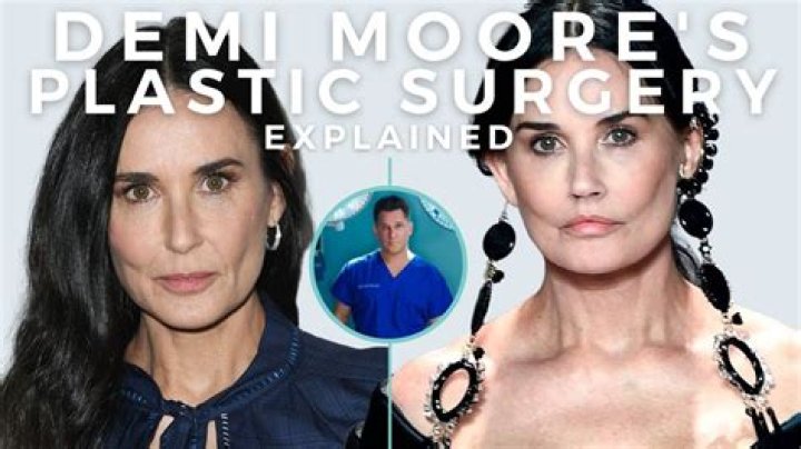 Demi Moore Surgery: What Happened to Demi Moore Face?