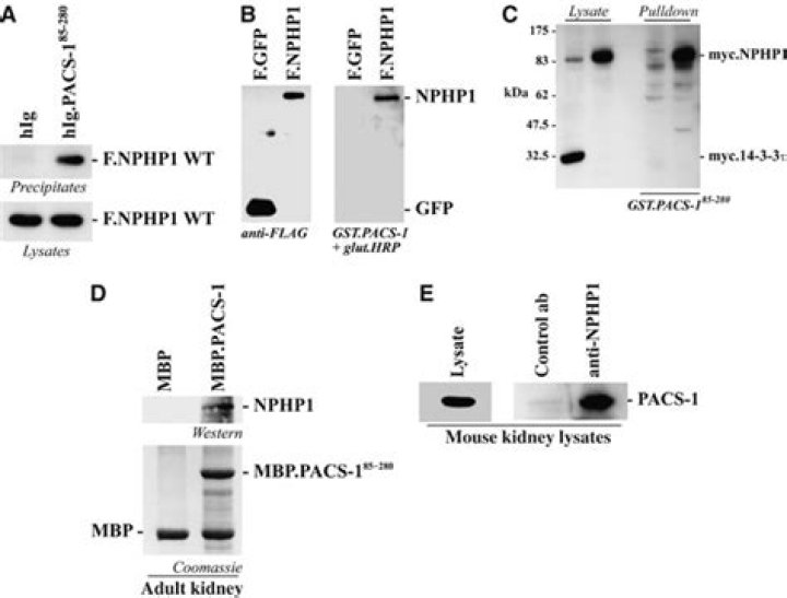 Nephrocystin-1 interacts directly with Ack1 and is expressed in human collecting duct - ePrints
