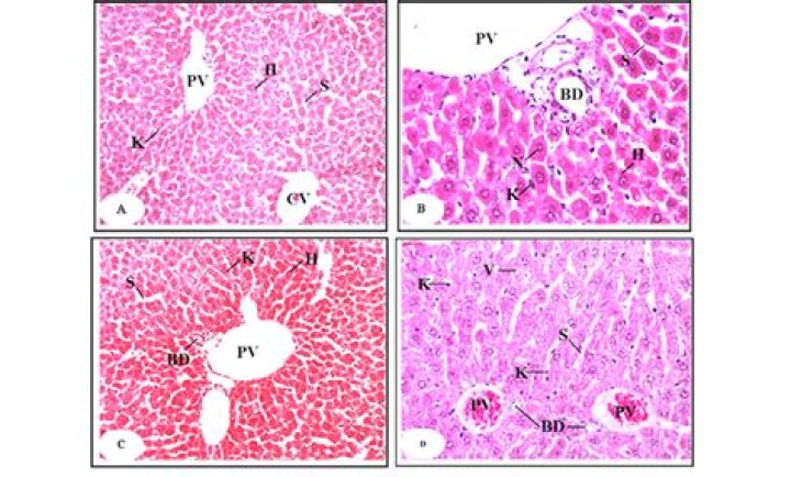 Pathology of the Liver Sinusoids - ePrints