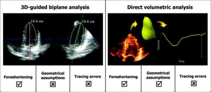 Real-time 3-dimensional Doppler echocardiography for the assessment of stroke volume: An in vivo human study compared with standard 2-dimensional echocardiography - ePrints