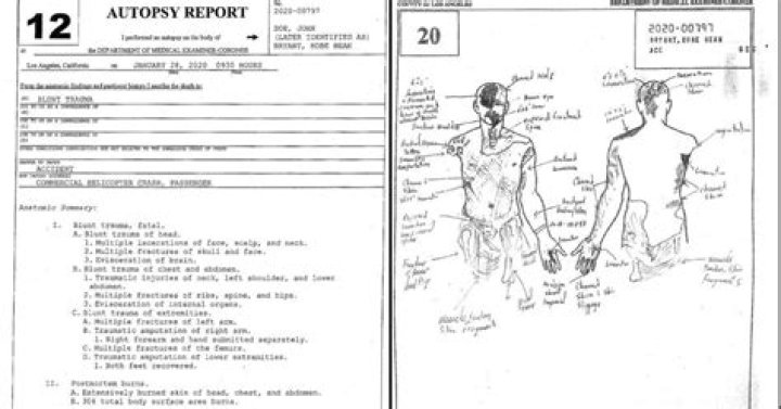 Taylor Hawkins Autopsy Photos, What Were His Last Words?